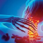 7 طرق لعلاج خشونة الرقبة