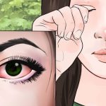 7 أعراض لحساسية العين في الربيع