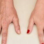 5 أسباب لتجاعيد اليدين