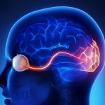ما هي أعراض ضمور العصب البصري؟