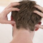 5 أسباب لحكة فروة الرأس وعلاجها