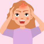 ما أسباب ظهور حبوب في فروة الرأس؟