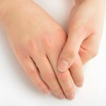 ما أسباب تقشر جلد اليدين ؟