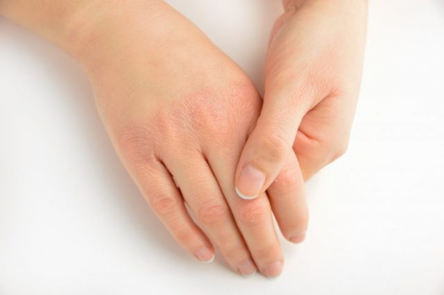 ما أسباب تقشر جلد اليدين ؟