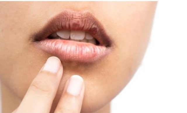 ما أسباب الجفاف حول الفم؟