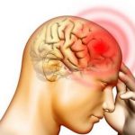 ما أعراض الجلطة الدماغية؟