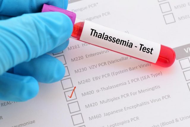علاج مرض الثلاسيميا
