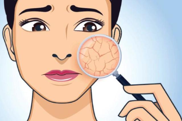 كيفية علاج جفاف الوجه